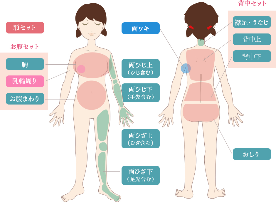 キッズ美肌脱毛 部位一覧